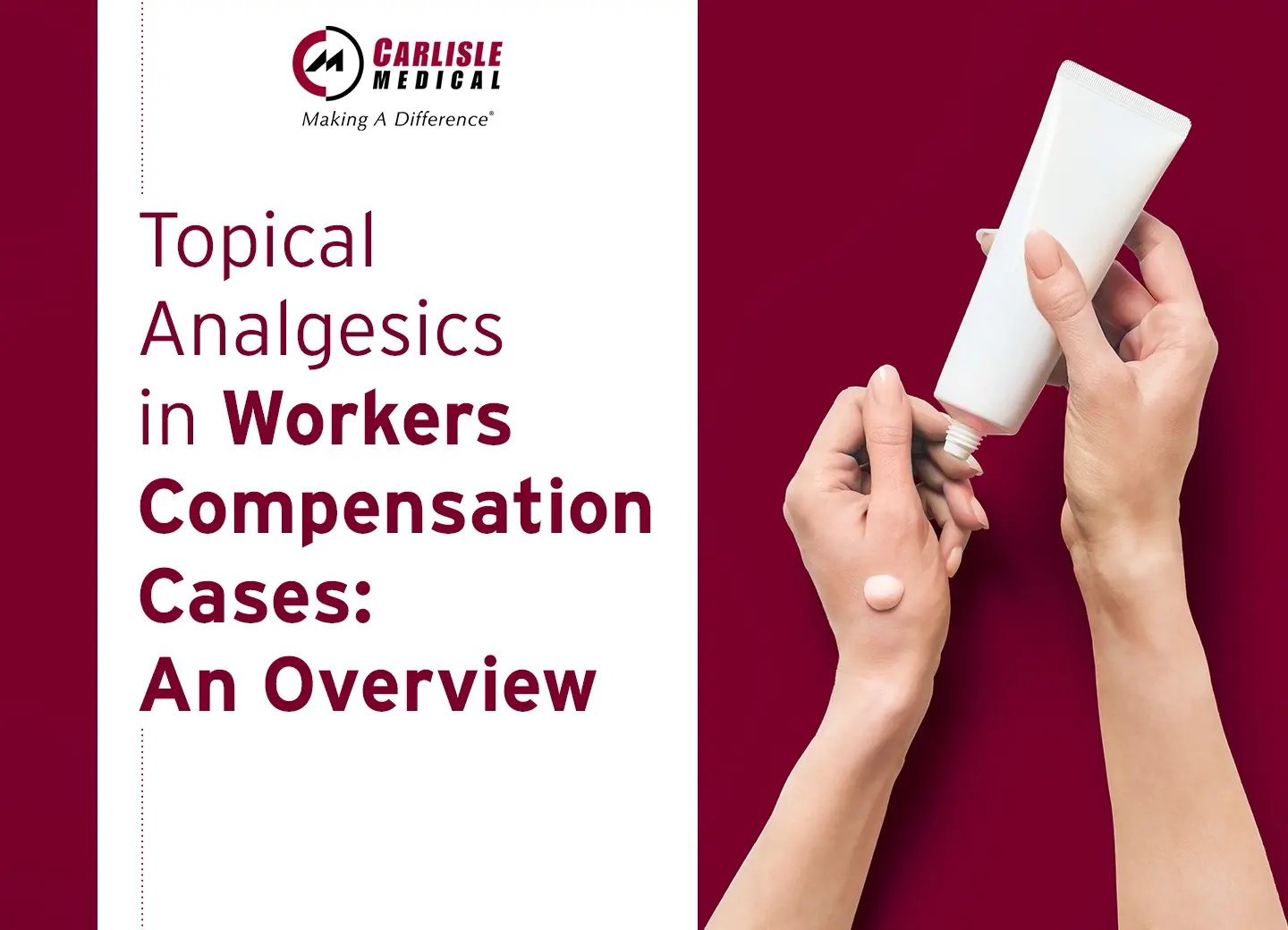 Topical Analgesics in Workers Compensation Cases: An Overview