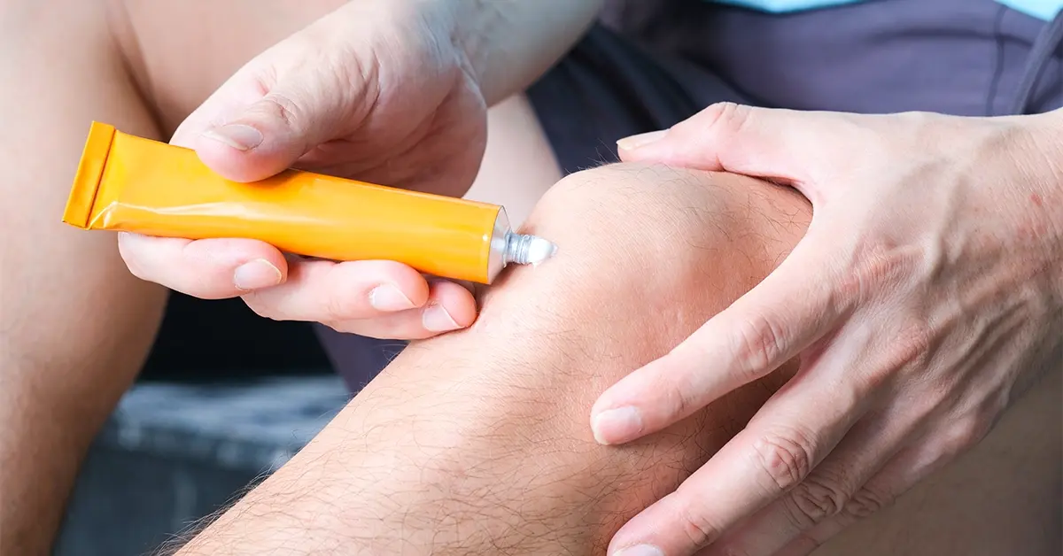 man's knee with topical ointment getting applied